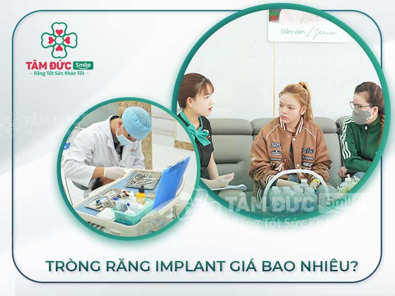 BẢNG GIÁ TRỒNG RĂNG IMPLANT NHƯ THẾ NÀO LÀ CHUẨN NHẤT HIỆN NAY?