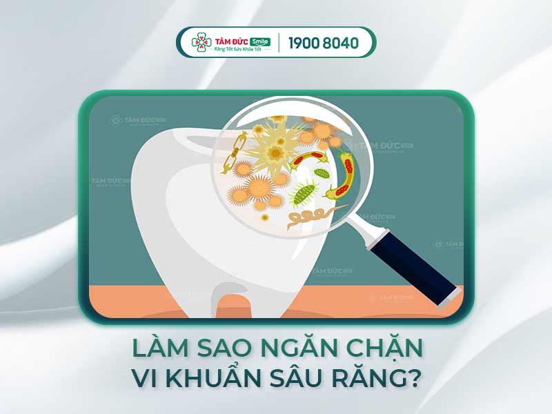 5 CÁCH NGĂN CHẶN VI KHUẨN SÂU RĂNG HIỆU QUẢ, DỄ THỰC HIỆN TẠI NHÀ