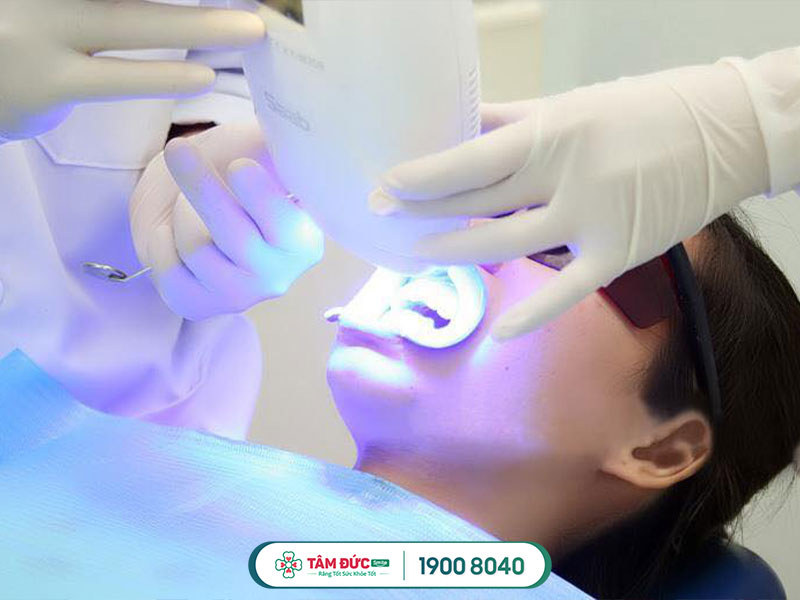 cách tẩy trắng răng tại nhà