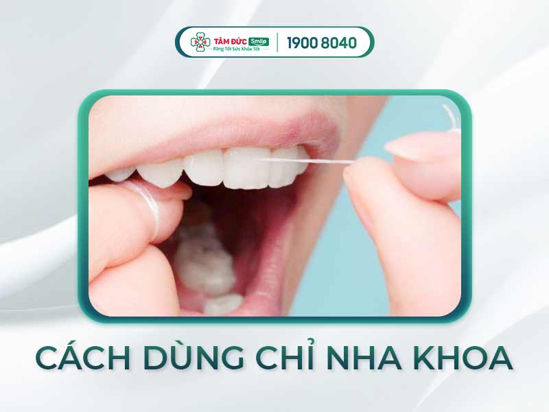 CÁCH XÀI CHỈ NHA KHOA CHÍNH XÁC VÀ HIỆU QUẢ CHO NGƯỜI MỚI BẮT ĐẦU