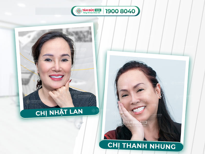 CẢM GIÁC SAU KHI BỌC RĂNG SỨ: 3 DẤU HIỆU BÌNH THƯỜNG VÀ 4 ĐIỀU BẤT THƯỜNG