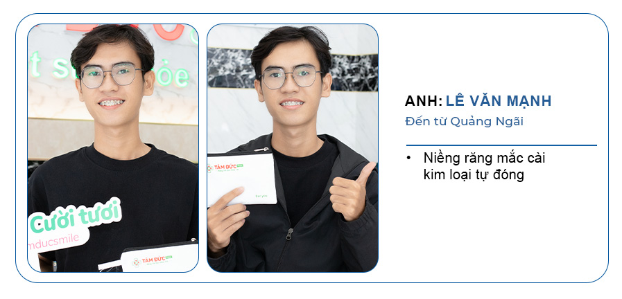 khách hàng niềng răng mắc cài kim loại