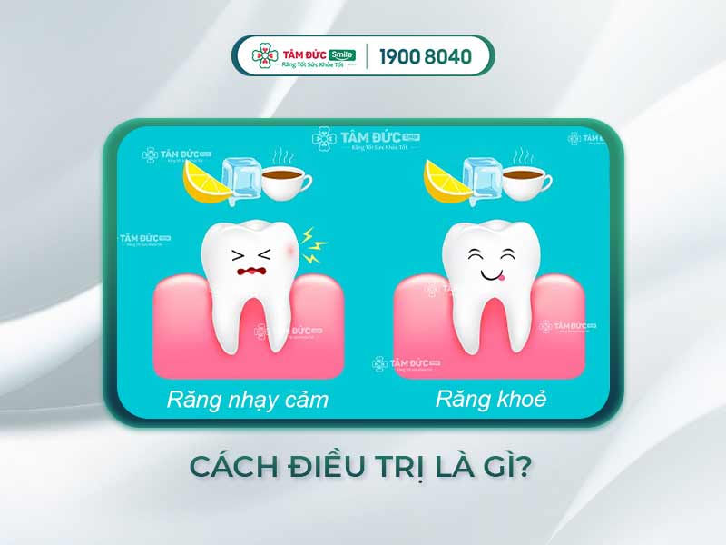 ĐIỀU TRỊ RĂNG NHẠY CẢM CẦN DỰA VÀO 6 YẾU TỐ SAU ĐÂY