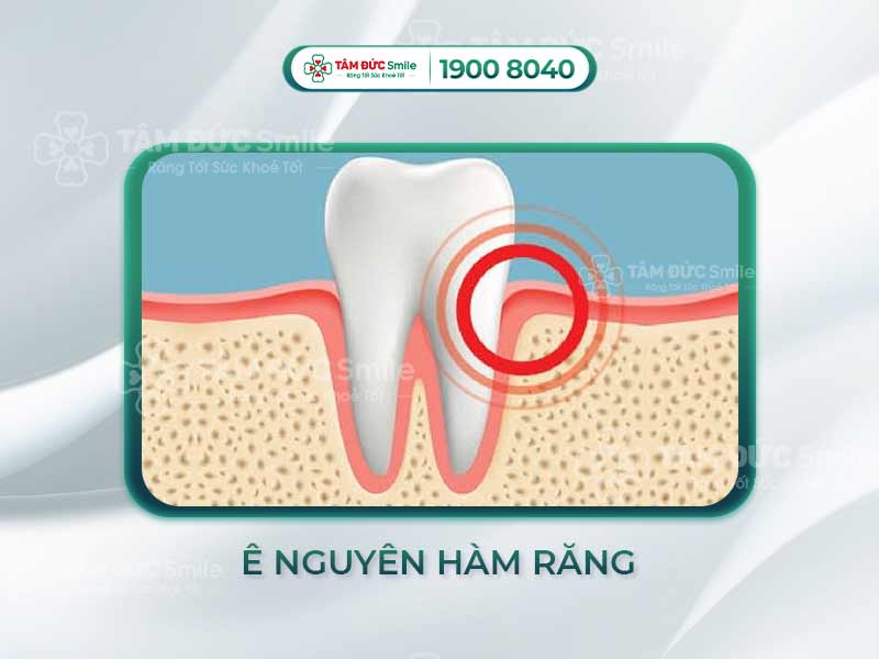 Ê NGUYÊN HÀM RĂNG LÀ DO ĐÂU? GIẢI PHÁP KHẮC PHỤC