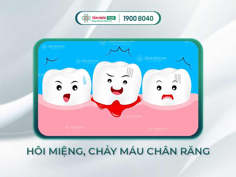 TRẺ BỊ HÔI MIỆNG CHẢY MÁU CHÂN RĂNG CÓ SAO KHÔNG? 5 CÁCH ĐIỀU TRỊ HIỆU QUẢ