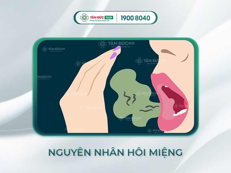 3 NGUYÊN NHÂN HÔI MIỆNG CHÍNH VÀ CÁCH ĐỂ BIẾT MÌNH CÓ BỊ HÔI MIỆNG HAY KHÔNG