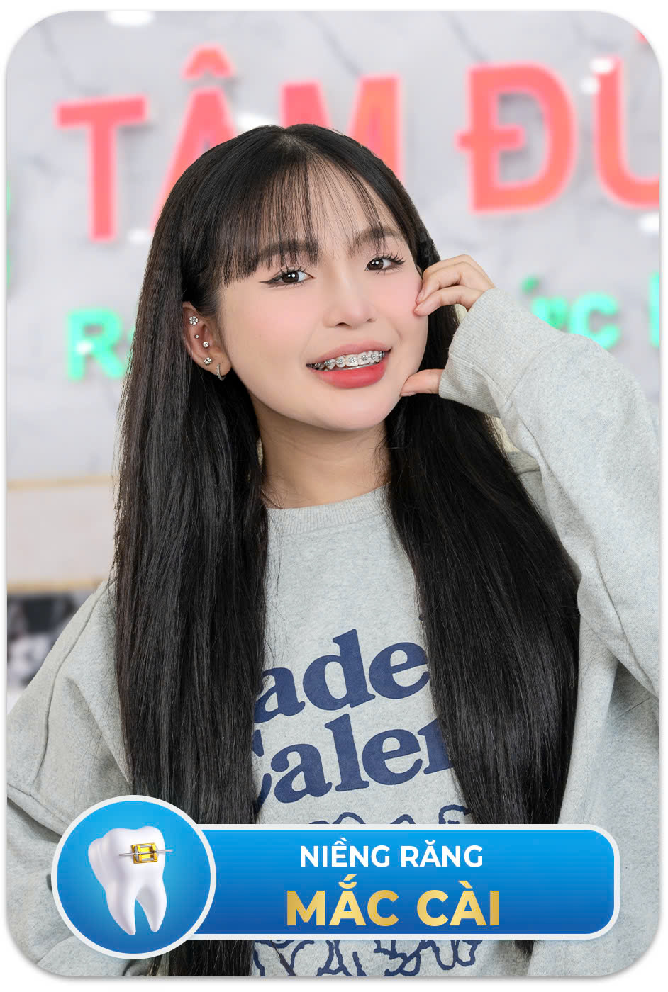 NIỀNG RĂNG THẨM MỸ