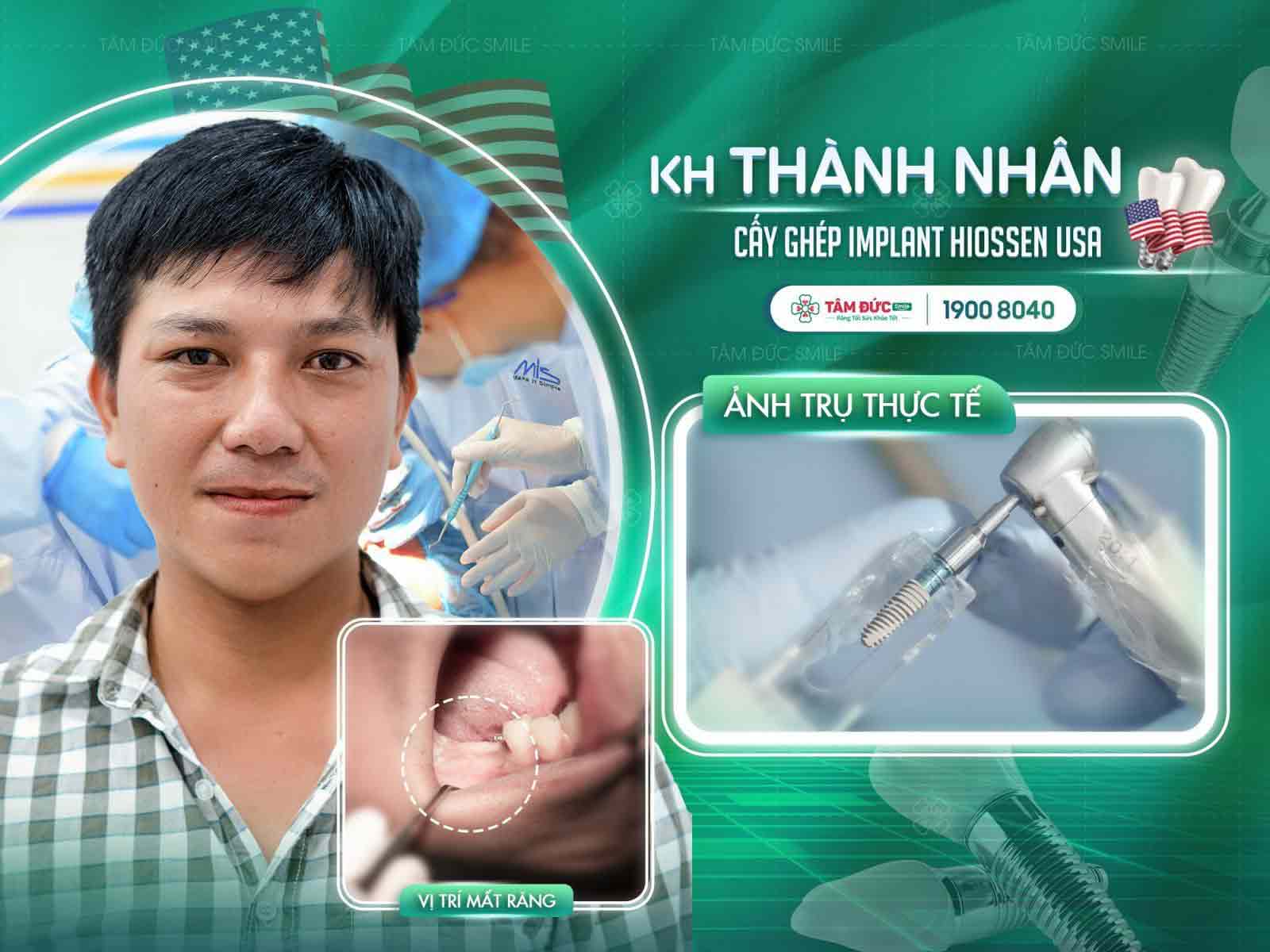 anh Nhân sau khi cấy Implant tại nha khoa Tâm Đức Smile