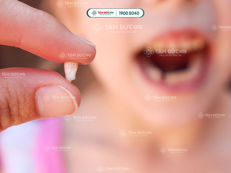 răng cối sữa có thay không