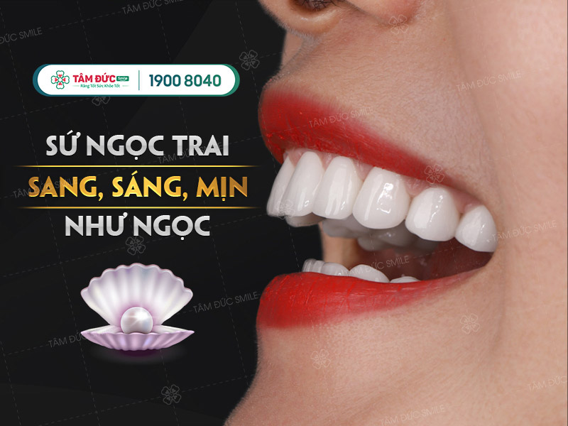 ưu điểm của răng sứ ngọc trai pearl smile