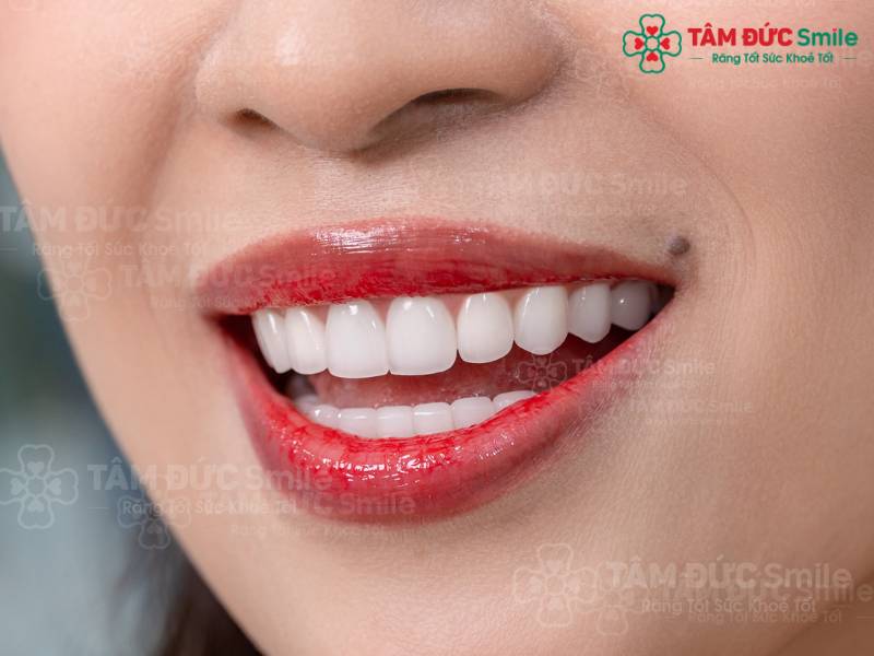 rãnh cười là gì