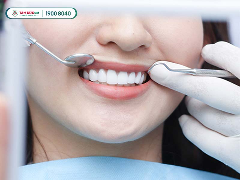 khach-hang-tay-trang-rang