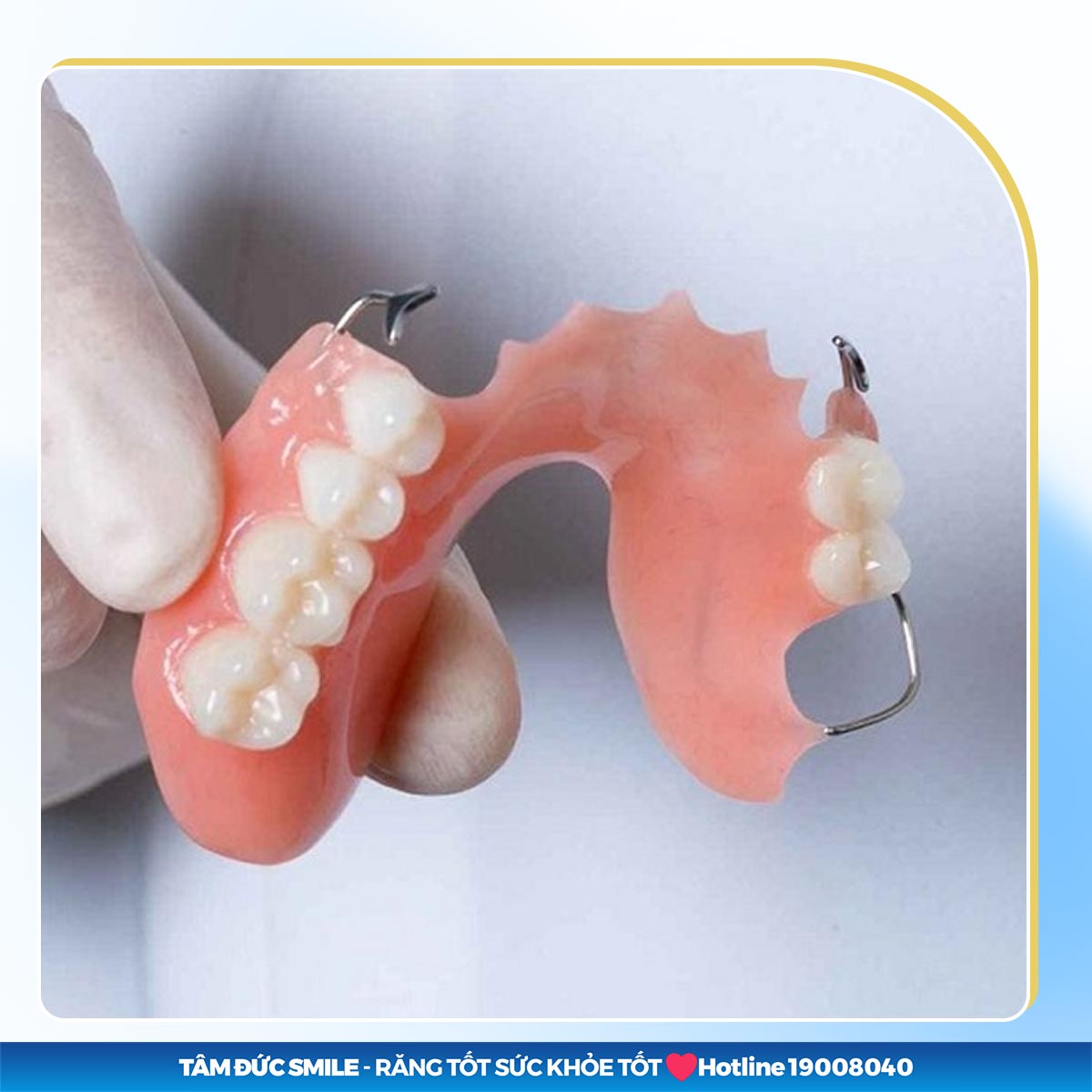 THẾ NÀO LÀ RĂNG GIẢ TẠM THỜI? SO SÁNH RĂNG GIẢ TẠM THỜI VỚI RĂNG VĨNH VIỄN