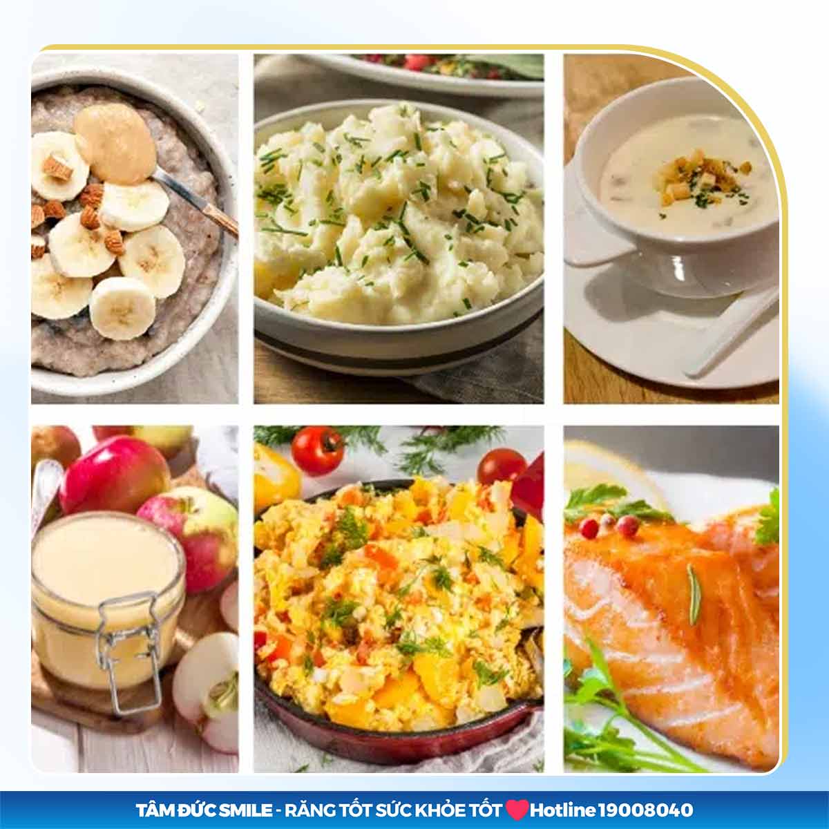 TRỒNG RĂNG IMPLANT BAO LÂU THÌ ĂN ĐƯỢC? NÊN KIÊNG VÀ ĂN GÌ?