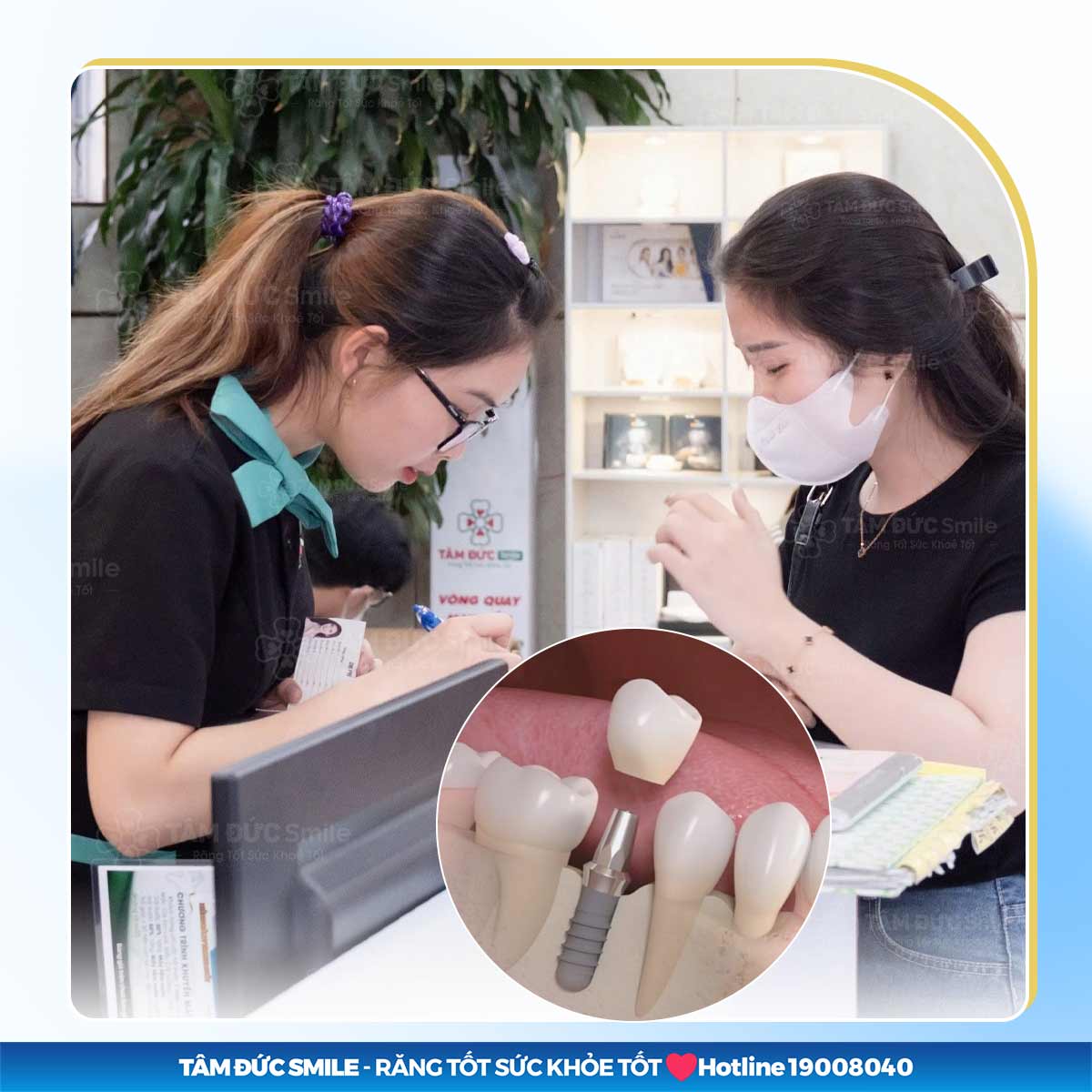 TRỒNG RĂNG RẺ NHẤT LÀ BAO NHIÊU? CÓ THẬT SỰ TỐT KHÔNG?