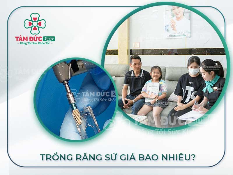 TRỒNG RĂNG SỨ BAO NHIÊU TIỀN? BẢNG GIÁ TRỒNG RĂNG