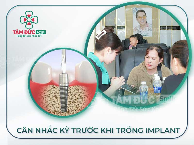 ĐIỂM MẶT 7 TRƯỜNG HỢP KHÔNG NÊN CẤY GHÉP IMPLANT