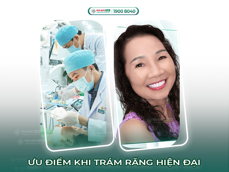 ƯU, NHƯỢC ĐIỂM CỦA 5 HÌNH THỨC TRÁM RĂNG PHỔ BIẾN NHẤT HIỆN NAY