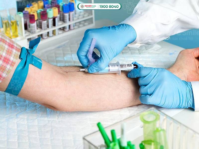 Xét nghiệm máu có được ăn không